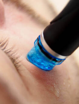 Hydrofacial