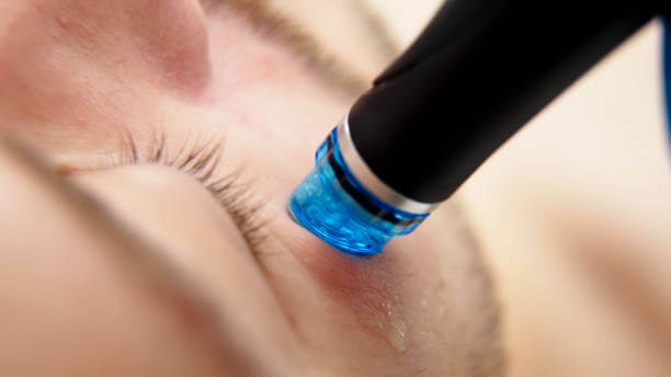 Hydrofacial