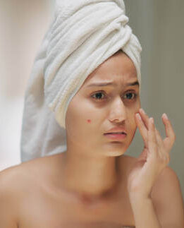 Acne & Pimples